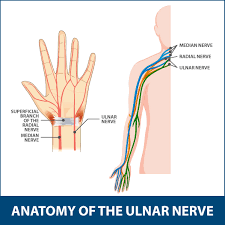 Medial epicondyle fractures comprise most of these injuries. Ulnar Neuritis Information Florida Orthopaedic Institute