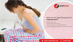 Endo belly can be the result of endometriosis implants and may get better after surgical removal of the disease. Endometriosis Symptoms Stages
