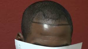 Sets in the java collection framework for this week's lab, you will use two of the classes in the java collection framework: How To Stop Receding Hairline For Black Men