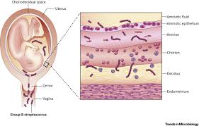 Image result for Group B Streptococcus