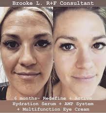 Rodan and Fields