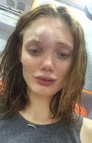 Russian Vogue Model Shares Shocking Photos of Her Battered Face After  Alleged Assault by Boyfriend