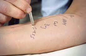 Allergy Testing And Recommended Allergy Diagnostic Tests