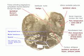 102,827 likes · 261 talking about this. Stroke Medicine For Stroke Physicians And Neurologists