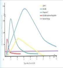 Cardiac Enzymes Cardiac Nursing Medical Mnemonics