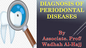 23 Diagnosis Of Periodontal Diseases Dr Wadhah Periodontology Lectures د وضاح الحاج Youtube