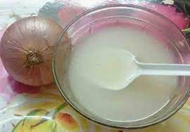 مين جربت مويه البصل للشعر موسوعة إقرأ مين جربت مويه البصل للشعر ومين جربت قشر البصل للشعر