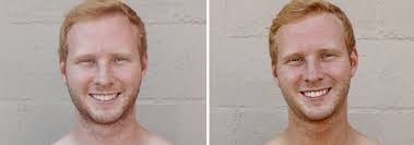Home hairgray hair can grey hair be reversed naturally? Gingers Get Spray Tans For The First Time