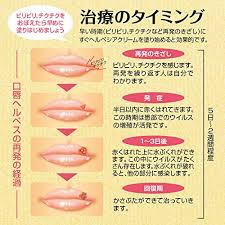 痛すぎる 口唇ヘルペスの原因と早く治す方法 効果的な食べ物や病院の処方薬や市販薬で早く治そう 暮らしラク