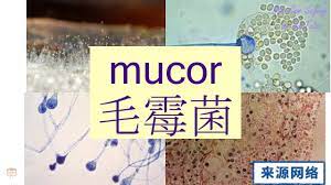 The site owner hides the web page description. Mucor In Cantonese æ¯›éœ‰èŒ Flashcard Youtube