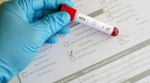 Hepatita b, în special, este cauzată de infecție cu virusul hepatitei b (hbv). Trei Noi Scheme De Tratament FÄrÄ Interferon Pentru Hepatita CronicÄ ViralÄ C Vor Fi Disponibile De La 1 Septembrie Fundatia Baylor Marea Neagra Baylor Romania