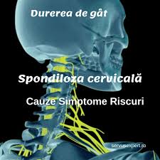 Nestiind exact ce presupun cele doua (mai ales prima, avand o oarecare idee. Spondiloza CervicalÄƒ AmeÈ›eala È™i Durere De Cap Servus Expert