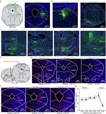 Image result for Silver Grey 1997 AAV