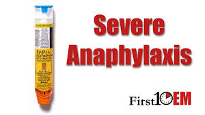 Image result for Anaphylaxis