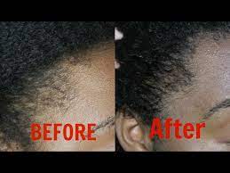 I decided to order more shampoo, more conditioner, the tibet tonic hair growth restorer, the serum gro scalp treatment and the. Haircare Deity America Review Youtube