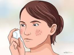 Beseitigen Von Grossen Poren Und Hautunreinheiten Hautunreinheiten Poren Grosse Poren