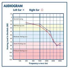 Understanding Your Audiogram