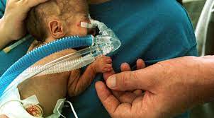 Hemoglobin Levels At Birth Affect Outcomes For Preterm Babies On Medicine