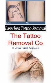 Advanced laser tattoo removal system. Where Can I Remove My Tattoo Tattoo Removal Bristol The Laserless Tattoo Removal Guide Tattoo Removal 4397328518 Tattoocoverup Tattooremovalathome Tattoor