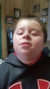 Keegan's Walk Through Life with NMD