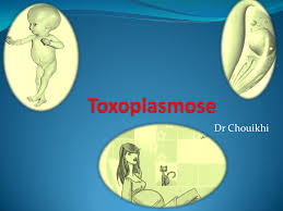 Toxoplasmose