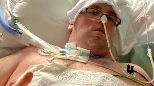 Long COVID changed his life. Now he's part of a study looking at the scope  of the problem in Sask.