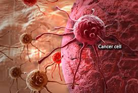 Sometimes, people with testicular cancer do not have any of these changes. 18 Common Cancer Symptoms And Signs In Men And Women