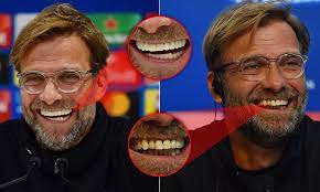 Klopp's teeth in sadder times. Mailonline Sport On Twitter Liverpool Manager Jurgen Klopp Flashes Whiter And Straighter Teeth In Spartak Moscow Press Conference Has He Had Veneers Fitted Https T Co Pty9yyph38 Https T Co Jy4cm2kmhm