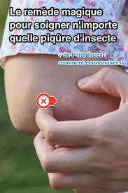Il n'a pas encore fait ses devoirs — il a déjà fait ses devoir. Le Remede Magique Pour Soigner N Importe Quelle Piqure D Insecte