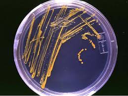 A culture, microbial or microbiological culture, is a technique that helps to multiply the microorganisms by allowing them to reproduce and divide in a prearranged culture medium under the controlled lab. Growth Medium Wikipedia