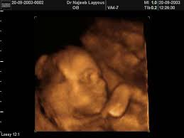 أشهر الحمل التسعة من أصعب الأوقات التي تمر على المرأة، حيث أنها تعاني من مشكلات عديدة بداية من الشهر الأول وحتى الشهر التاسع. Ø§Ù„Ø´Ù‡Ø± Ø§Ù„Ø³Ø§Ø¯Ø³ Ù…Ù† Ø§Ù„Ø­Ù…Ù„ ÙˆØ§Ù„Ø¬Ù…Ø§Ø¹ Ø§Ø¬Ù…Ù„ Ø¬Ø¯ÙŠØ¯