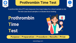 Image result for Prothrombin Time