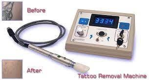 This is a dangerous method because you dermabrasion: Amazon Com Mini Portable Tattoo Removal Machine Best At Home Device Beauty Personal Care