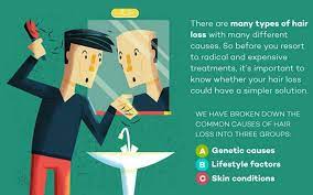 Here are some of the potential causes of hair loss in teenagers. Hair Tips Just For Men 7 Causes Of Male Hair Loss And How To Treat It