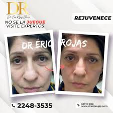 Dr. Eric Rojas Blanco