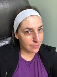 She's up for best supporting actress in a comedy series and is the first female from the big bang theory to ever today's guest: Mayim Bialik Gets Her First Ever Cosmetic Treatment