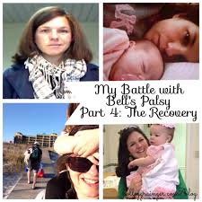 My Battle With Bell S Palsy Part 4 The Recovery Bells Palsy Bell S Palsy Symptoms Forehead Wrinkles