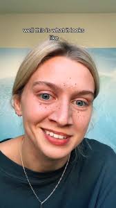 can i please just be an honorary member of the freckle community? :/