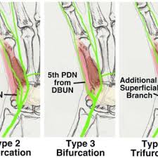 Tenga en cuenta que usted mismo puede cambiar de canal de transmisión en el apartado. Variations Of Berrettini Anastomosis The Berrettini Anastomosis Is A Download Scientific Diagram