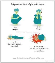 Pin On Trigeminal Neuralgia