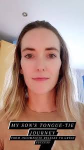 Edited to include details about first release, which was incomplete. , The  first release only divided the very front of my son's frenulum. It was  still very restricted at the back. I was not told and ...