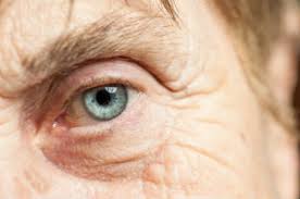 Fehlsichtige, die ihre sehstärke verbessern möchten, müssen volljährig sein. Augen Lasern Auch Im Alter Moglich Bewertet De
