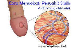 (nomor konfirmasi pembayaran tidak menerima layanan telpon). Pengobatan Herbal Penyakit Kelamin Obat Sipilis Atau Raja Singa