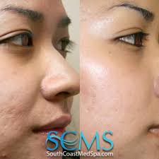 Mermaid Spa Los Angeles, CA