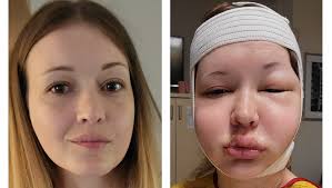 Fundraiser by Kelina Roberts : Please Help Me Live Again