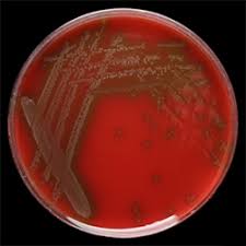 Image result for Penicillin Resistant Pneumococcus