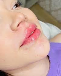 Dr. Daniel Avelino (@dr.danielavelino) • Instagram photos and videos