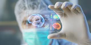 Imagini pentru boala huntington