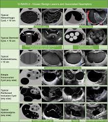 O Rads Us Risk Stratification And Management System A Consensus Guideline From The Acr Ovarian Adnexal Re In 2020 Medical Ultrasound Transvaginal Ultrasound Radiology
