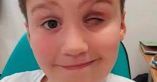 A également pour l'écouter sans que je faire ? Un Garcon De 9 Ans Perd Un Oeil A Cause D Un Jouet Tres Populaire Au Pres Des Enfants Nouvelles Ayoye Monde